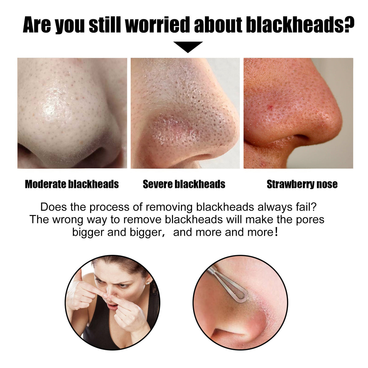 EELHOE Blackhead Removal Nose Strips