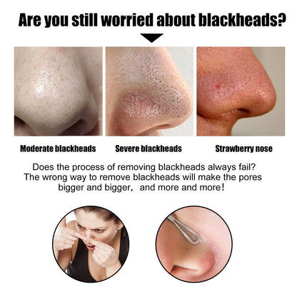 EELHOE Blackhead Removal Nose Strips