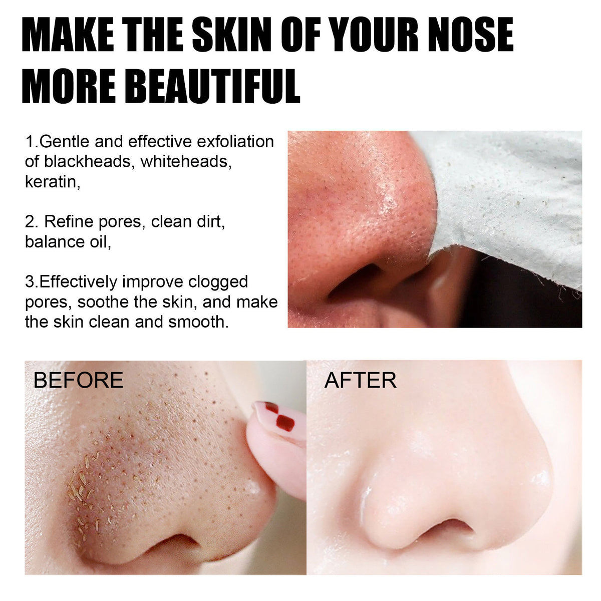 EELHOE Blackhead Removal Nose Strips