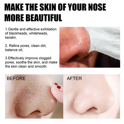EELHOE Blackhead Removal Nose Strips